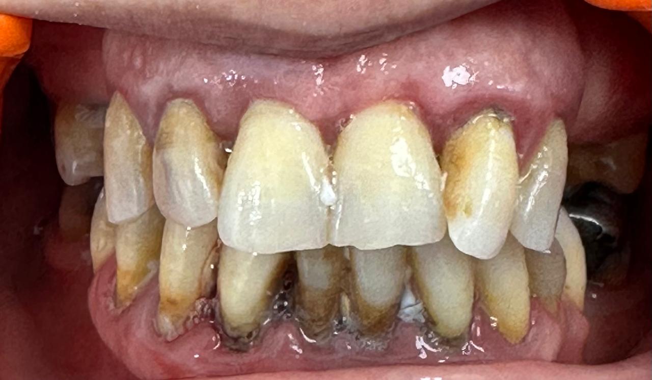 Avant - Centre Dentaire Zeggar Casablanca